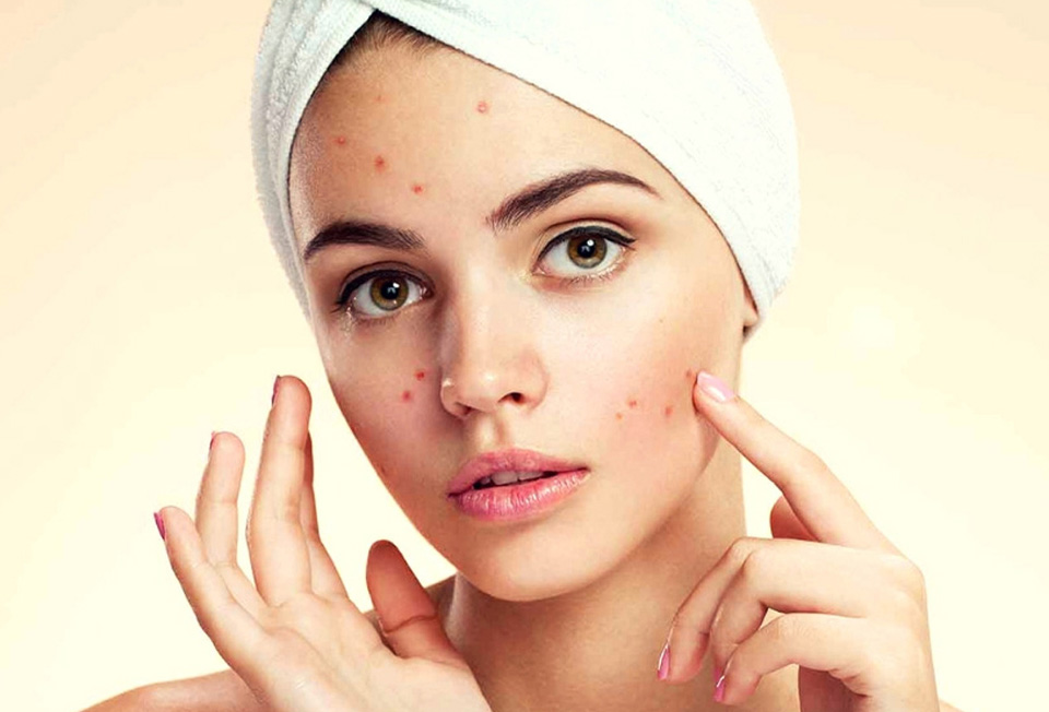 Best dermatologist in Kochi providing expert skincare treatments at Skinpal Clinic